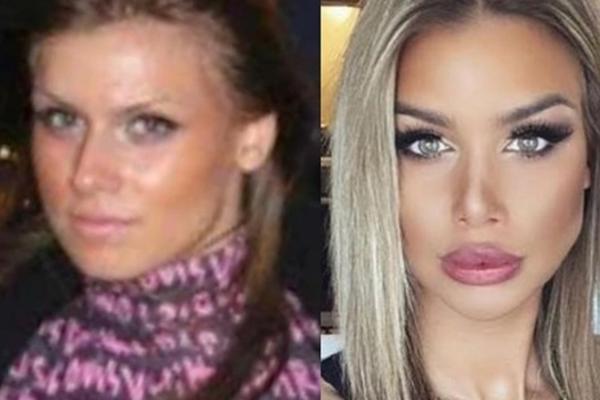 IVANA HURRICANE BEZ KOMPLEKSA POKAZALA SLIKE PRE OPERACIJA: Izazvala lavinu komentara na mreži!