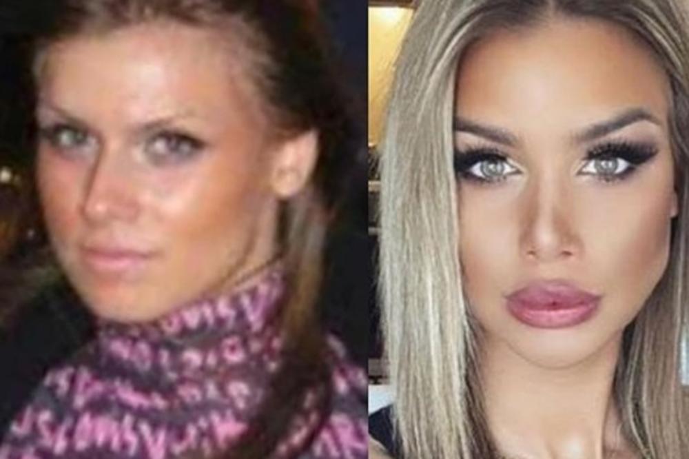 IVANA HURRICANE BEZ KOMPLEKSA POKAZALA SLIKE PRE OPERACIJA: Izazvala lavinu komentara na mreži!