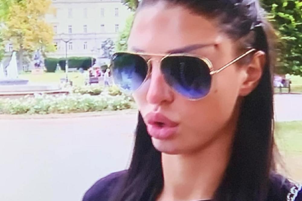 RUPE, OŽILJCI I PODLIVI: Maja Marinković sva u MODRICAMA! Takva je izašla pred kamere i pokazala tragove na licu!