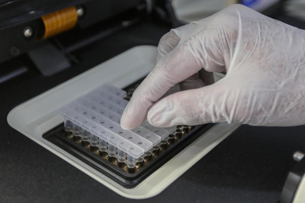 NOVA POŠAST JE NAPALA SVET USRED KORONE! Šta je to BUBONSKA KUGA i koji su njeni SIMPTOMI?!