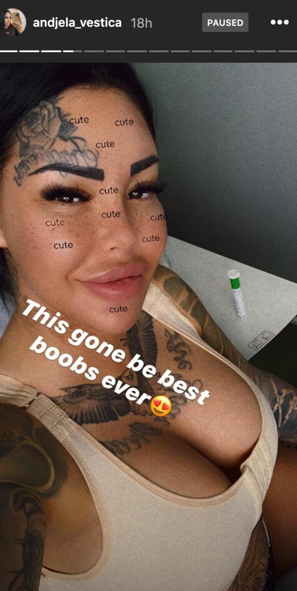 ANĐELA VEŠTICA PONOVO IDE POD NOŽ!? Još više će ih uvećati, a ovako je to  NAJAVILA! (FOTO)