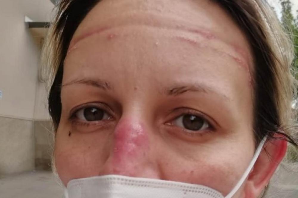 BOJANA JE MEDICINSKA SESTRA NA KiM: Ona leči Srbe od korone, a njen vapaj morate da poslušate! SVA JE U RANAMA!