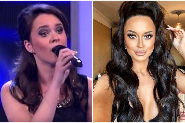 PROSLAVILA JE JEDNA PESMA PREKO NOĆI! Žena od Sultana je svašta KORIGOVALA NA SEBI, evo i kako je nekada izgledala