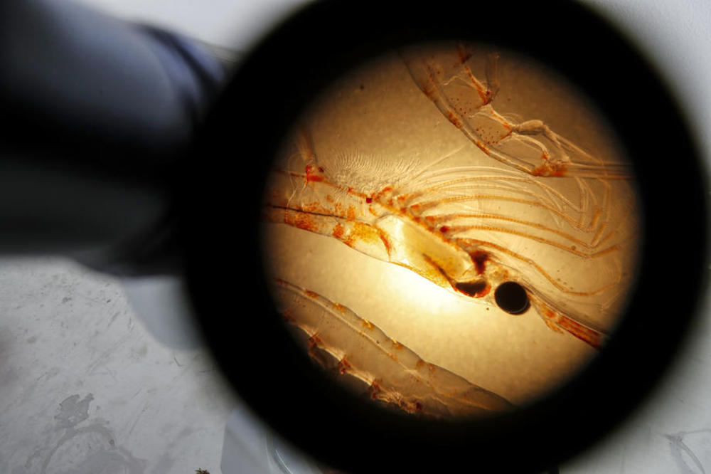 Previše čistoće može narušiti zdravlje: Ovi ljudi su to osetili na svojoj koži, evo šta se desilo!