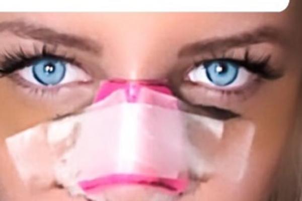 NENORMALNA SUMA! Pogledajte koliko košta novi nos buduće zadrugarke!