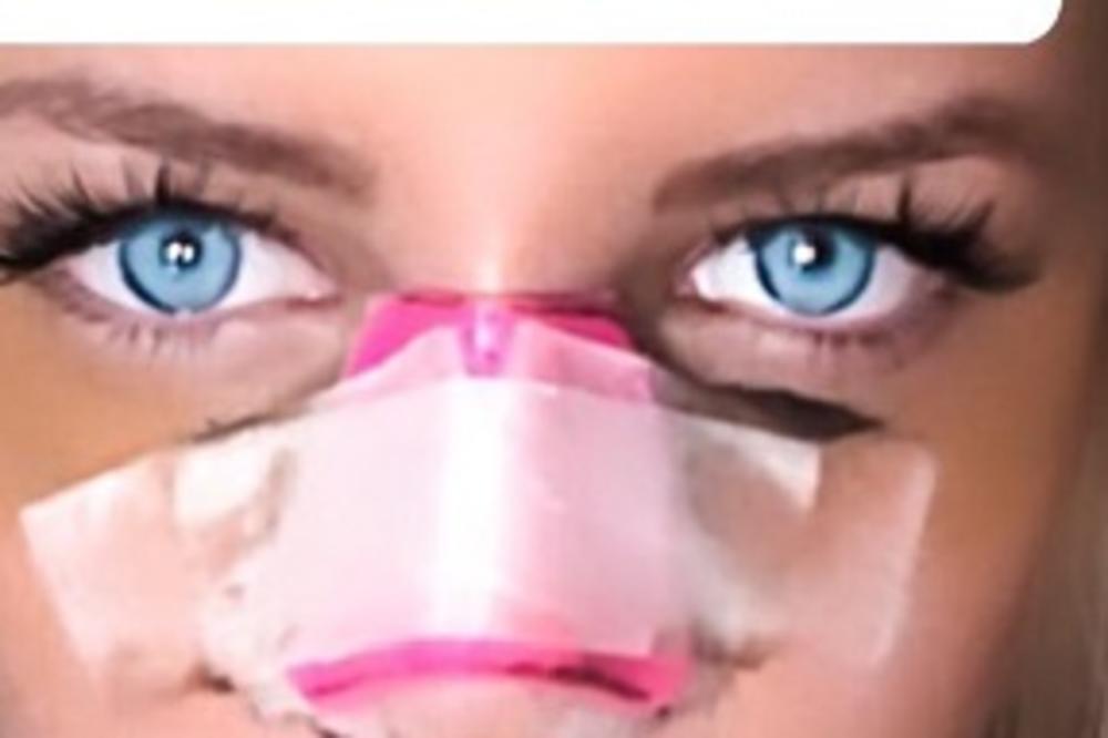 NENORMALNA SUMA! Pogledajte koliko košta novi nos buduće zadrugarke!