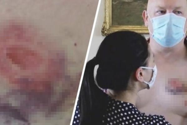 PRIGOVORIO JE ČOVEKU U AUTOBUSU ŠTO NE NOSI MASKU: Ovaj ga je ujeo, ali to nije najgore u celoj priči (FOTO)