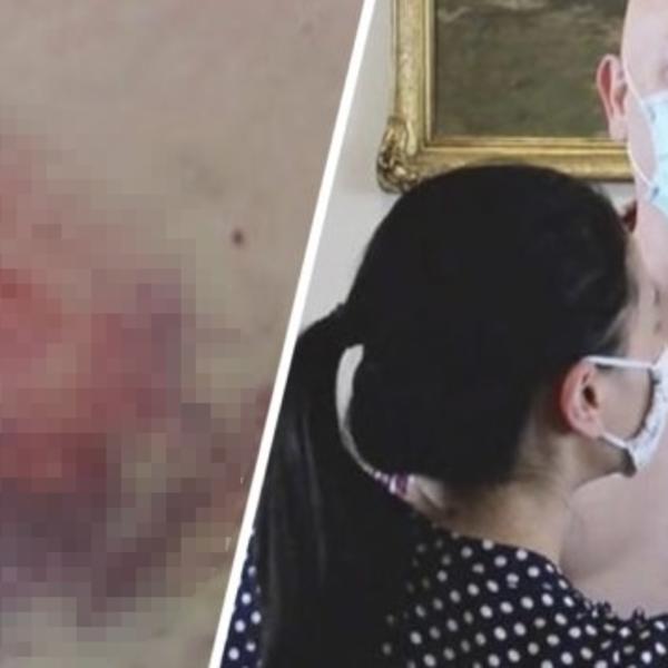 PRIGOVORIO JE ČOVEKU U AUTOBUSU ŠTO NE NOSI MASKU: Ovaj ga je ujeo, ali to nije najgore u celoj priči (FOTO)