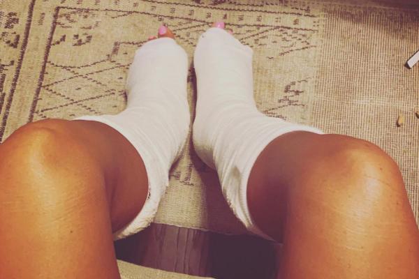 STARLETA SE JEZIVO POVREDILA! Polomila oba stopala! (FOTO)