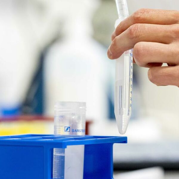 BAŠ LOŠA VEST: Otkriveno da dve vakcine protiv korone imaju MNOGO SLABIJI UČINAK na novi soj iz Južne Afrike!