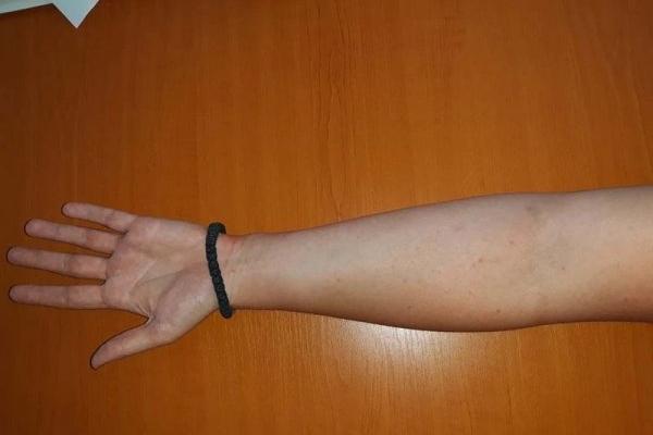 UŽASNO! DECA OSTALA BEZ DELA ŠAKE: Niški lekari zbrinuli njih 254 za SEDAM GODINA, evo kako im se to dogodilo!