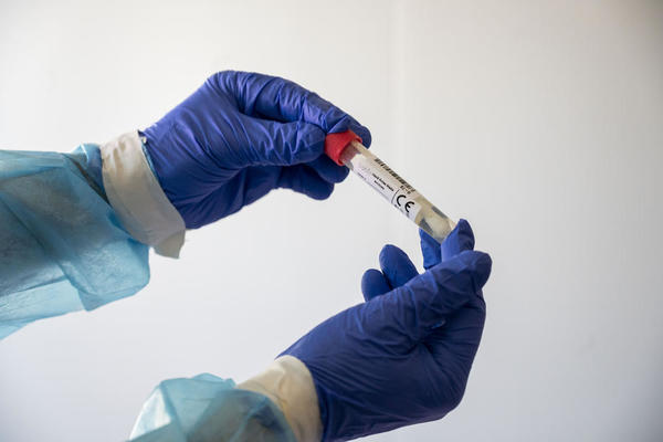 VANREDNE INSPEKCIJE otkrile da antigenske testove radi i laboratorije koje nemaju ovlašćenje
