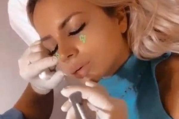 BUDUĆA ZADRUGARKA SE SAMO PUMPA! Nakon operacije nosa otišla kod PLASTIČARA da uradi OVO! (FOTO)