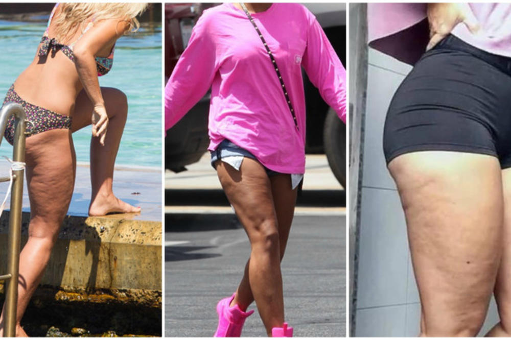 OVE SLAVNE LEPOTICE SU OBJAVILE FOTOGRAFIJE S GOMILOM CELULITA: Možete samo da ih mrzite, njih baš briga