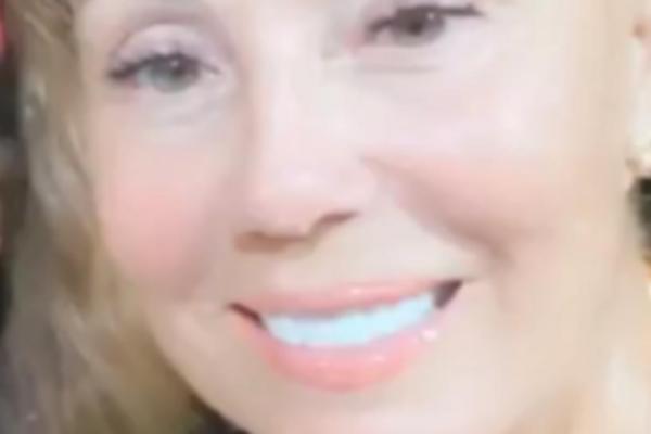 BRENA NAJPRE OSEDELA, ONDA JE TAPIRALA KOSU DA JOJ IZGLEDA BUJNO! Ovo je pravo stanje, ostala sa 3 dlake na glavi