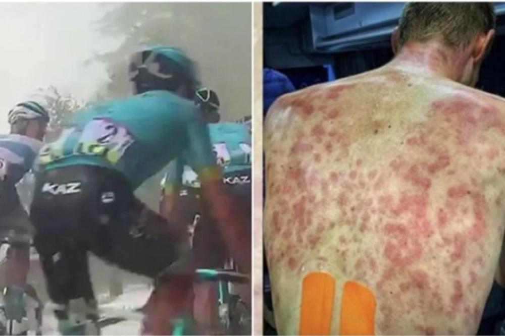 POGLEDAJTE LEĐA BICIKLISTE POSLE TRKE: Izgledaju jezivo, a nikad ne biste pogodili šta je uzrok tome!