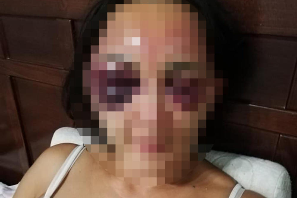 SATIMA JE TUKAO SUPRUGU DO NEPREPOZNATLJIVOSTI: Uhapšen sutradan, ali je odmah pušten bez ikakvih sankcija!