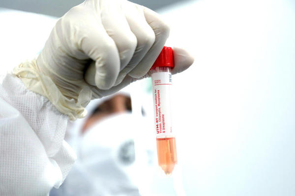 HITNA VEST STIŽE IZ POLJSKE, ODMAH SE OGLASIO DVORČIK: Tiče se VAKCINACIJE PROTIV KORONE!