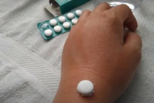 UJED OVOG INSEKTA MOŽE BITI SMRTONOSAN! Ako vam se to ikada desi, odmah uradite stvar koja će vam spasti život!