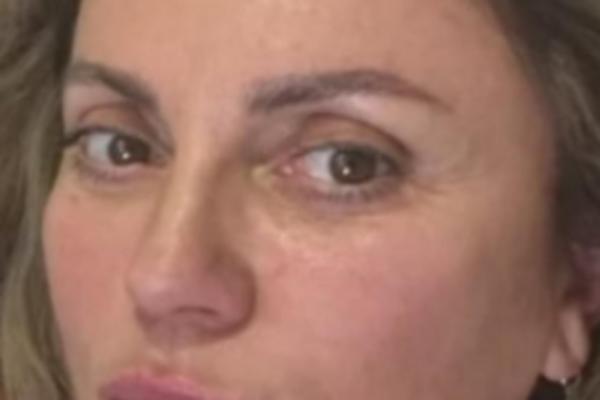 INDIRU RADIĆ SVI PAMTE KAO ZGOĐUŠNU, SA OBLINAMA, A BILA JE I LEPA: Više ni šminkom ne može da sakrije ovo na licu