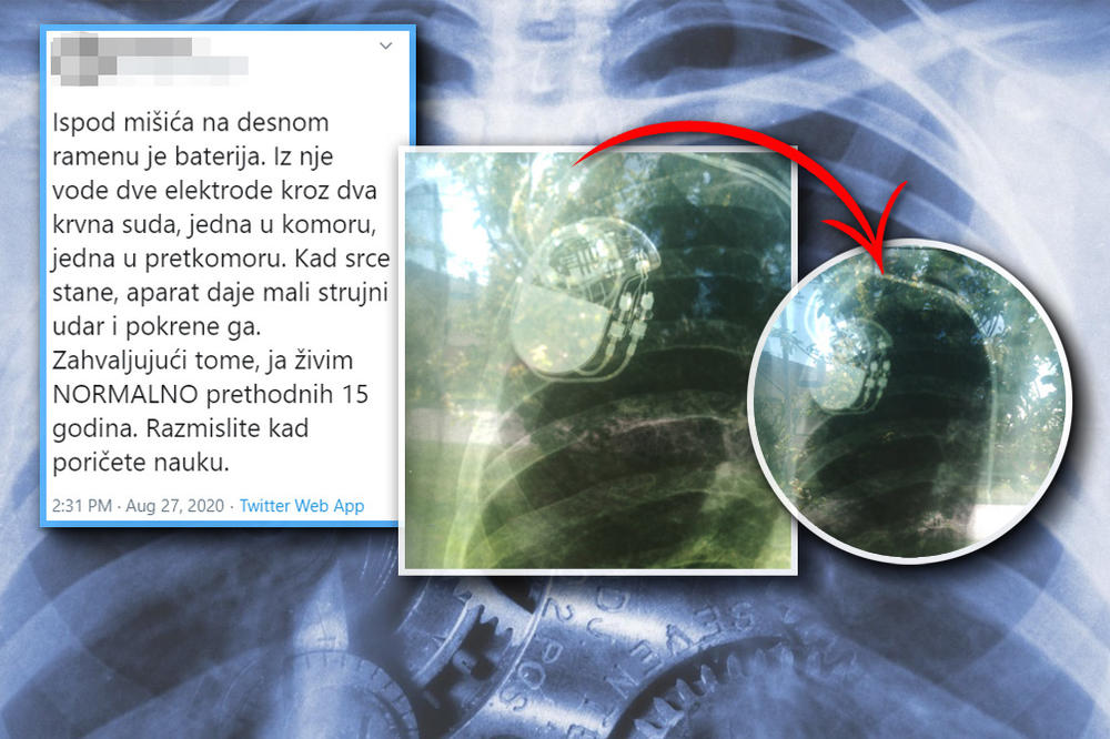 OSEĆAM KAD SE UKLJUČI I POMISLIM, MOGLA SAM DA BUDEM MRTVA: Dragana nosi ožiljak kao znak da je pobedila smrt