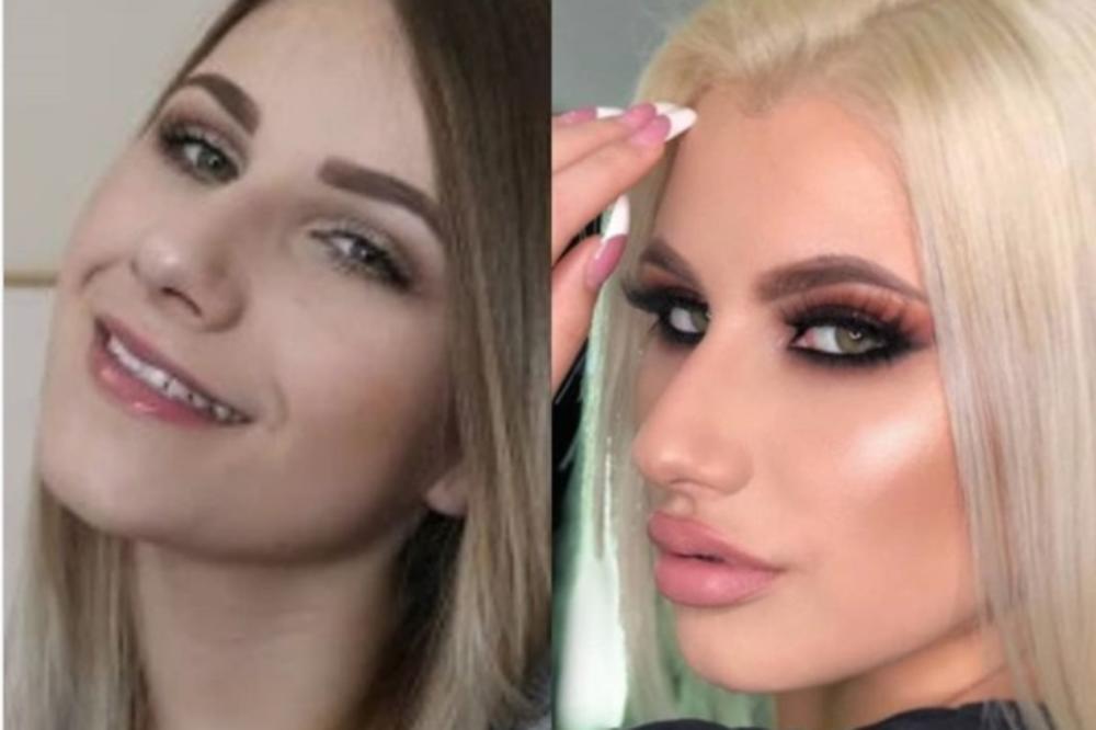 IDOL MLADIH NE LIČI NA SEBE: Isplivale fotografije Ruže Rupić pre estetskih korekcija (FOTO)