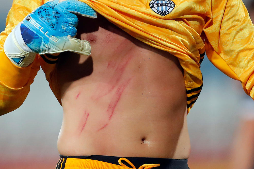 SUDIJA ĐORĐIĆU, DA LI VAS JE SAD BAR MALO SRAMOTA? Golman TSC završio u Urgentnom - celu noć je prolazio kroz pakao