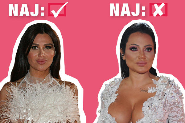 ESPRESO NAJ OD NAJ BIRA CICU OD PLASTIKE! Jedna je umalo UMRLA, a druga je postala prava BOMBA!