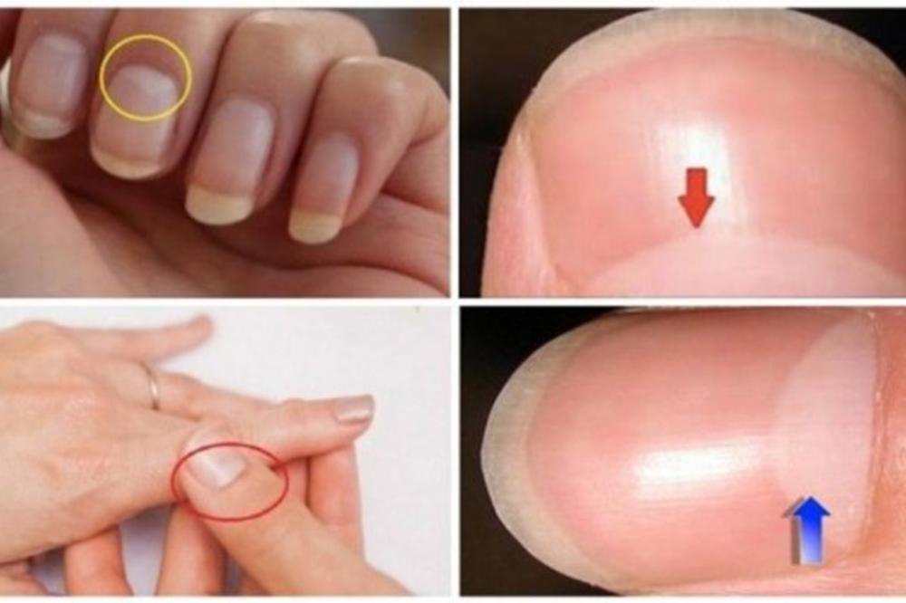 POGLEDAJTE POLUMESEC NA NOKTIMA: Znate li šta znači? I TE KAKO JE VAŽAN