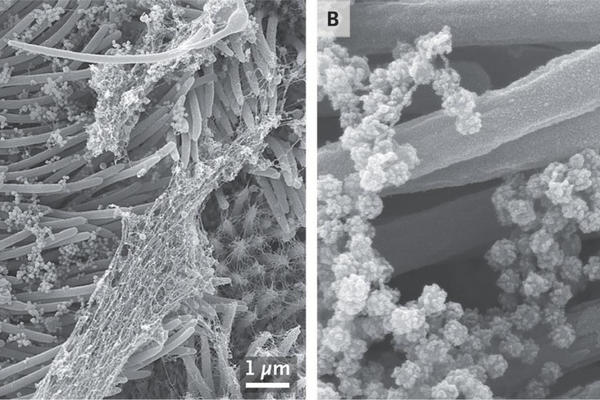 OVO JE NAJVEĆE OTKRIĆE DO SADA! Naučnici otkrili ŠTA POMAŽE KORONI DA SE ŠTO VIŠE RAZVIJE U ORGANIZMU!