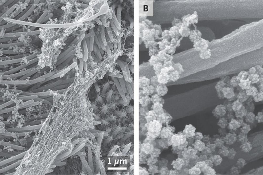 MINISTAR SE OGLASIO, SADA JE I DEFINITIVNO: Pojavio se NOVI SOJ KORONE! Ovo je njegovo ime i SVIREP JE!