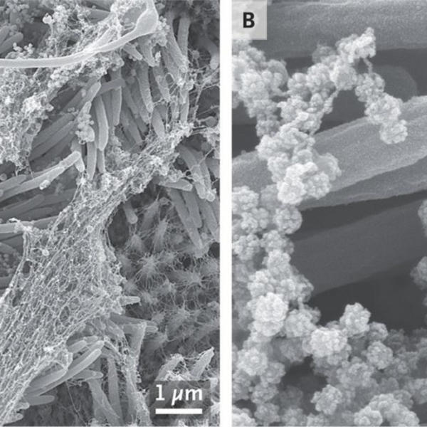 KOMŠIJE OTKRILE NOVI SOJ KORONA VIRUSA: Nakon analize došli do OVOG ZAKLJUČKA, hoće li vakcina pomoći?