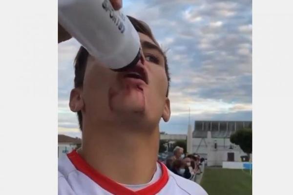 SNIMAK BIZARNE POVREDE FUDBALERA OBIŠAO JE REGION: Pogledajte samo šta se desi kad popije vodu! (VIDEO)