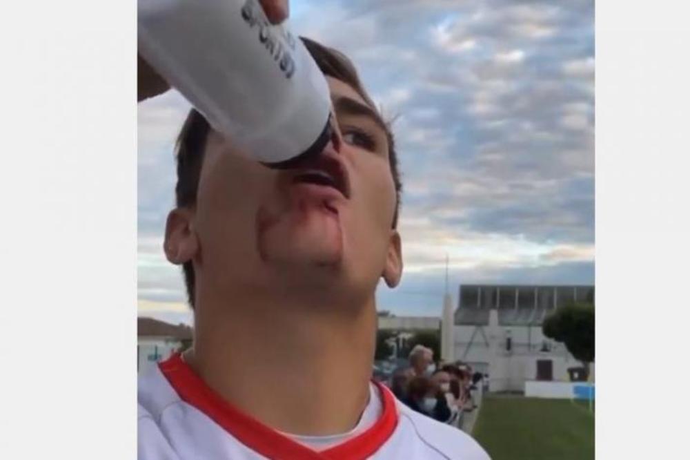 SNIMAK BIZARNE POVREDE FUDBALERA OBIŠAO JE REGION: Pogledajte samo šta se desi kad popije vodu! (VIDEO)