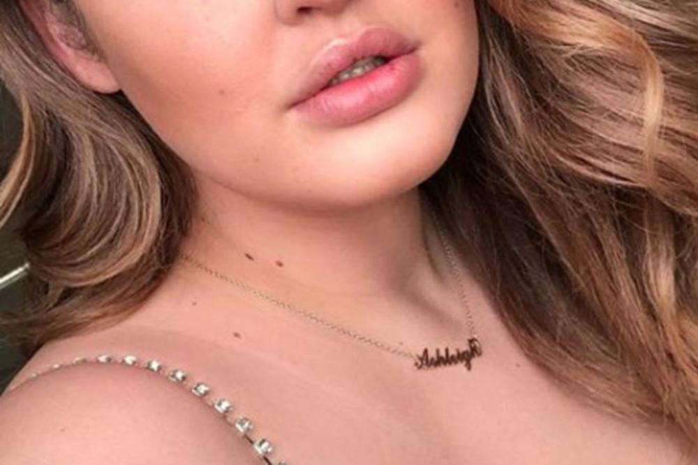 ŽELE DA DOBIJEM KANCER! POZNATA MANEKENKA PROLAZI KROZ PAKAO I TRPI JEZIVE NAPADE! Narod je PROKLEO zbog ponašanja