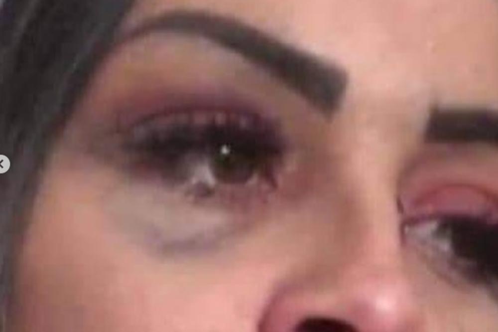 PSIHOPATE IDITE NA DADOVE NASTUPE, SJAŠITE S MENE! Zerina objavila slike svojih MODRICA! POTRESNO (FOTO)