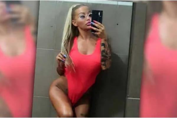 IZVRŠILA KOMPLETNU REKONSTRUKCIJU LICA: Bivša zadrugarka neprepoznatljiva, posle silnih operacija OVAKO izgleda!