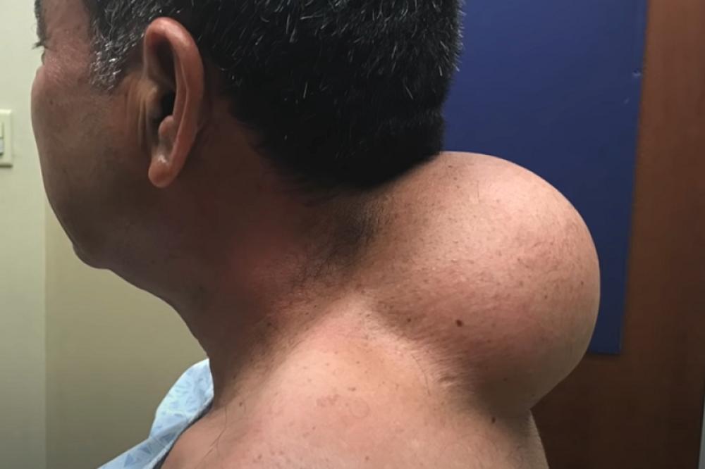 IMAO JE JEZIVU IZRASLINU Evo kako je doktorka napravila ČUDO i rešila ga muka! (UZNEMIRUJUĆI VIDEO)