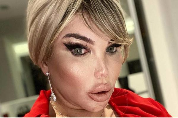 LJUDSKI KEN OBJAVIO FOTKU BEZ FILTERA: Šta je sa MOZGOVIMA koji i dalje pristaju da ga operišu? (FOTO)