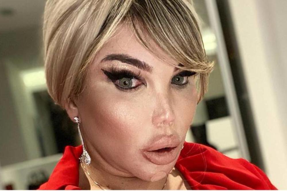 LJUDSKI KEN OBJAVIO FOTKU BEZ FILTERA: Šta je sa MOZGOVIMA koji i dalje pristaju da ga operišu? (FOTO)