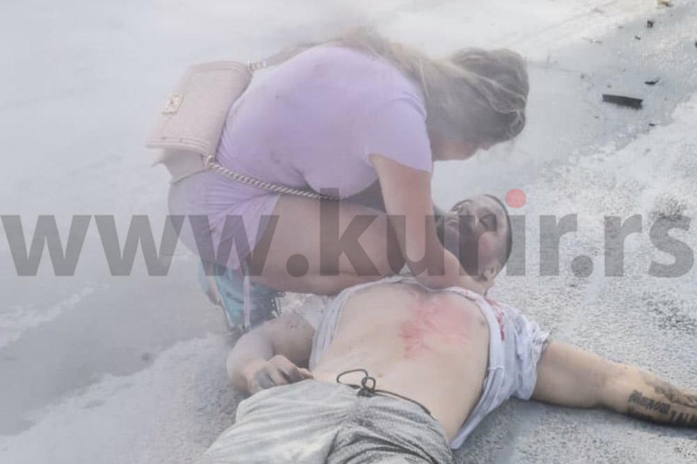 STRAVIČNE slike Strahinje koji umire i Kolumbijke koja vrišti posle eksplozije (UZNEMIRUJUĆE FOTOGRAFIJE)