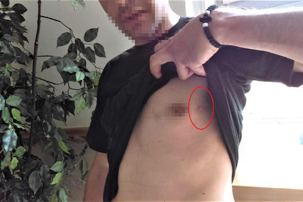 RASPLET NA VIDIKU: Beograđanin bio na ivici smrti zbog Nišlijke, isplivali svi detalji krvave drame!