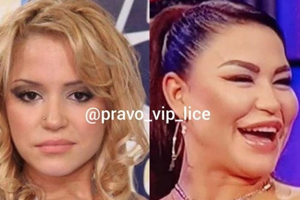 POGLEDAJTE KAKO ZAISTA IZGLEDAJU POSLEDICE BOTOKSIRANJA U 26.GODINI: Aleksandra je sebe potpuno uništila (FOTO)