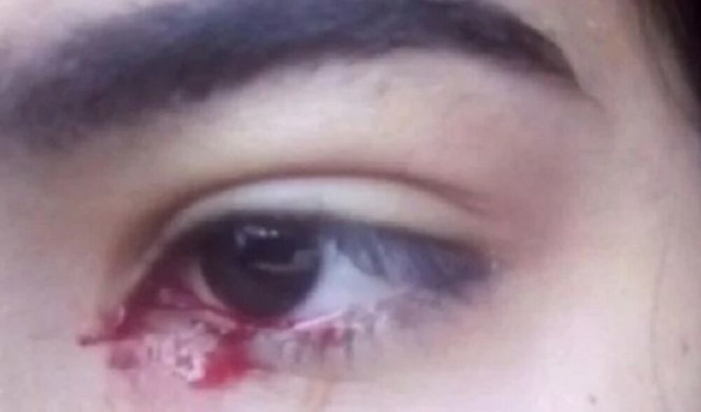 Krv, Brazilka, Doris