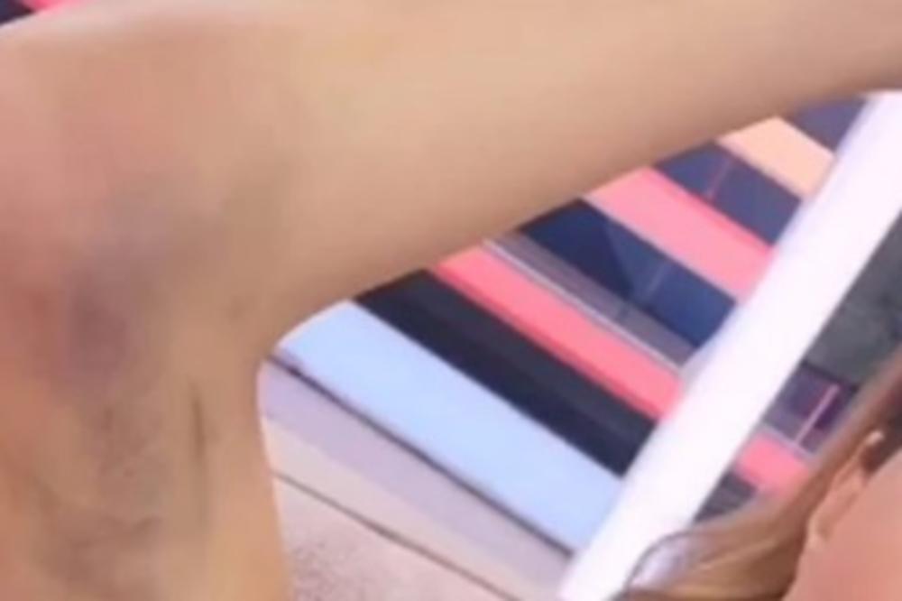 HOROR U JUTARNJEM PROGRAMU! Voditeljka ušla u studio sva u modricama, otkrila sve o PAKLU kroz koji je prošla