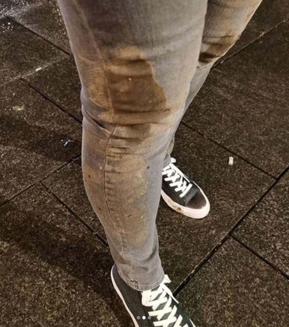 Pantalone nakon napada 
