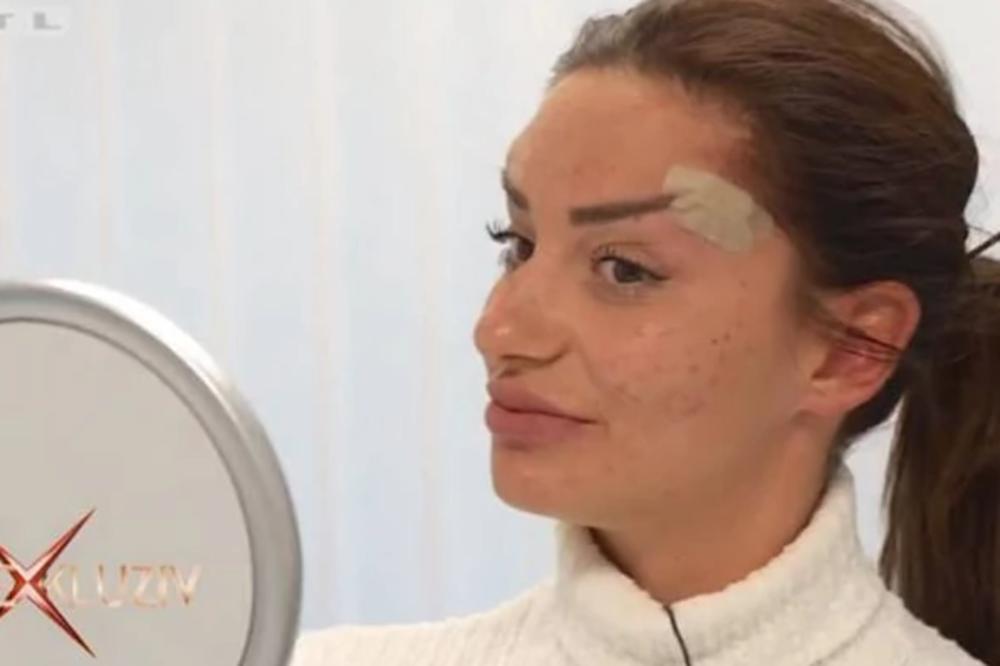 KRISTINA MANDARINA JE MNOGO MLADA, SADA I MNOGO IZOPERISANA, ULOŽILA VELIKE PARE DA PROMENI LICE: Šok fotke, o ne