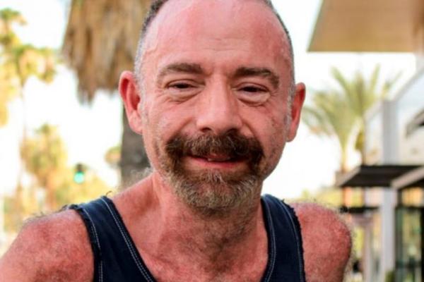 BIO JE PRVA OSOBA IZLEČENA OD HIV-A, ALI OVU BOLET NIJE PREŽIVEO: Preminuo PACIJENT svima znan umro je OVAKO