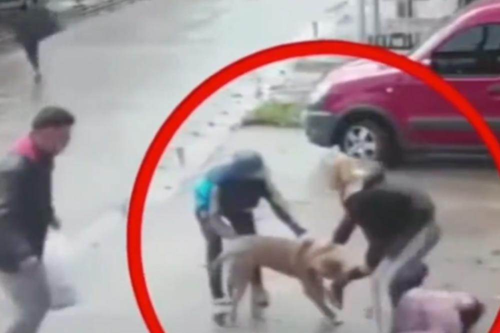 NAJSTRAVIČNIJI SNIMAK 2020. GODINE! Pitbul napao devojčicu (7), potpuno joj je UNIŠTIO NOGE! (UZNEMIRUJUĆI VIDEO)