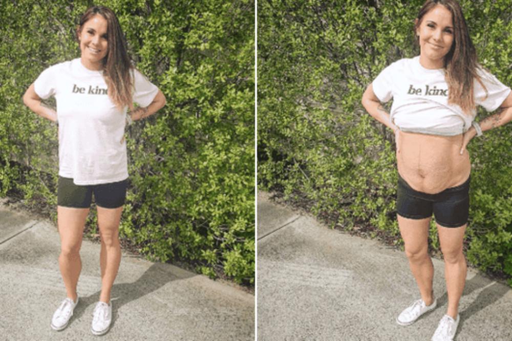 RODILA JE ČETVORKE I PODIGLA MAJICU: Ovako njeno telo sada izgleda (FOTO)